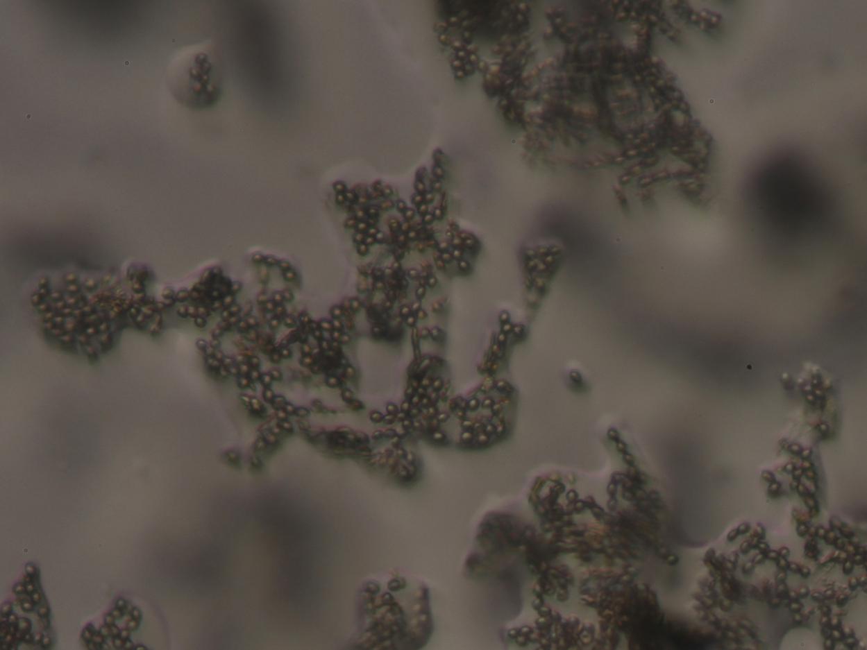 Imagen microscópica de esporas de hongos de muestra tomada desde el documento